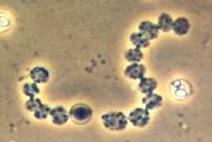 Photo of cyanobacteria